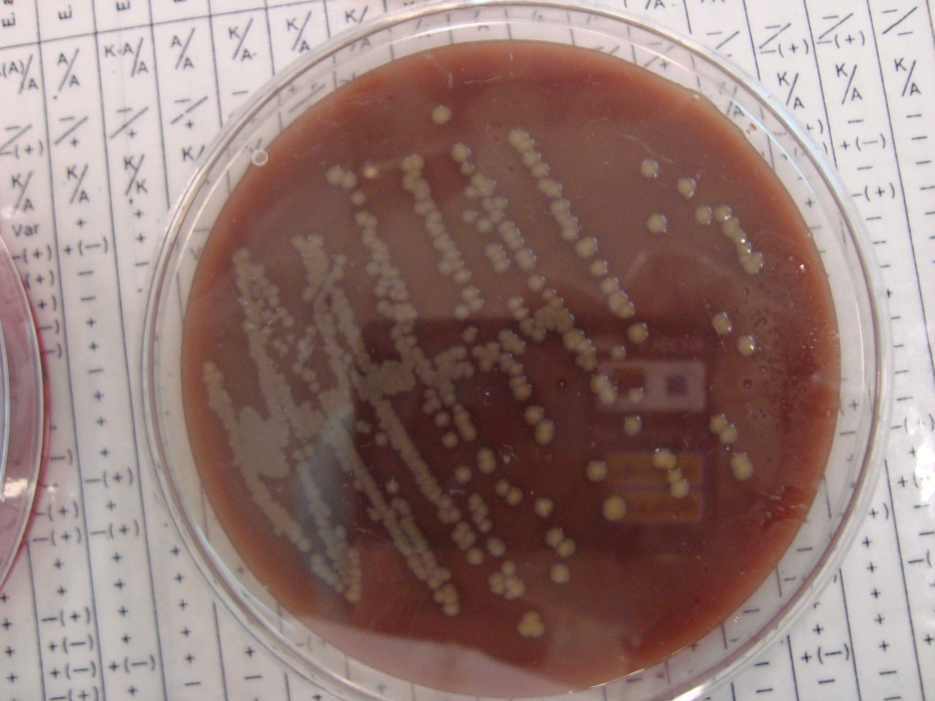 E.Coli